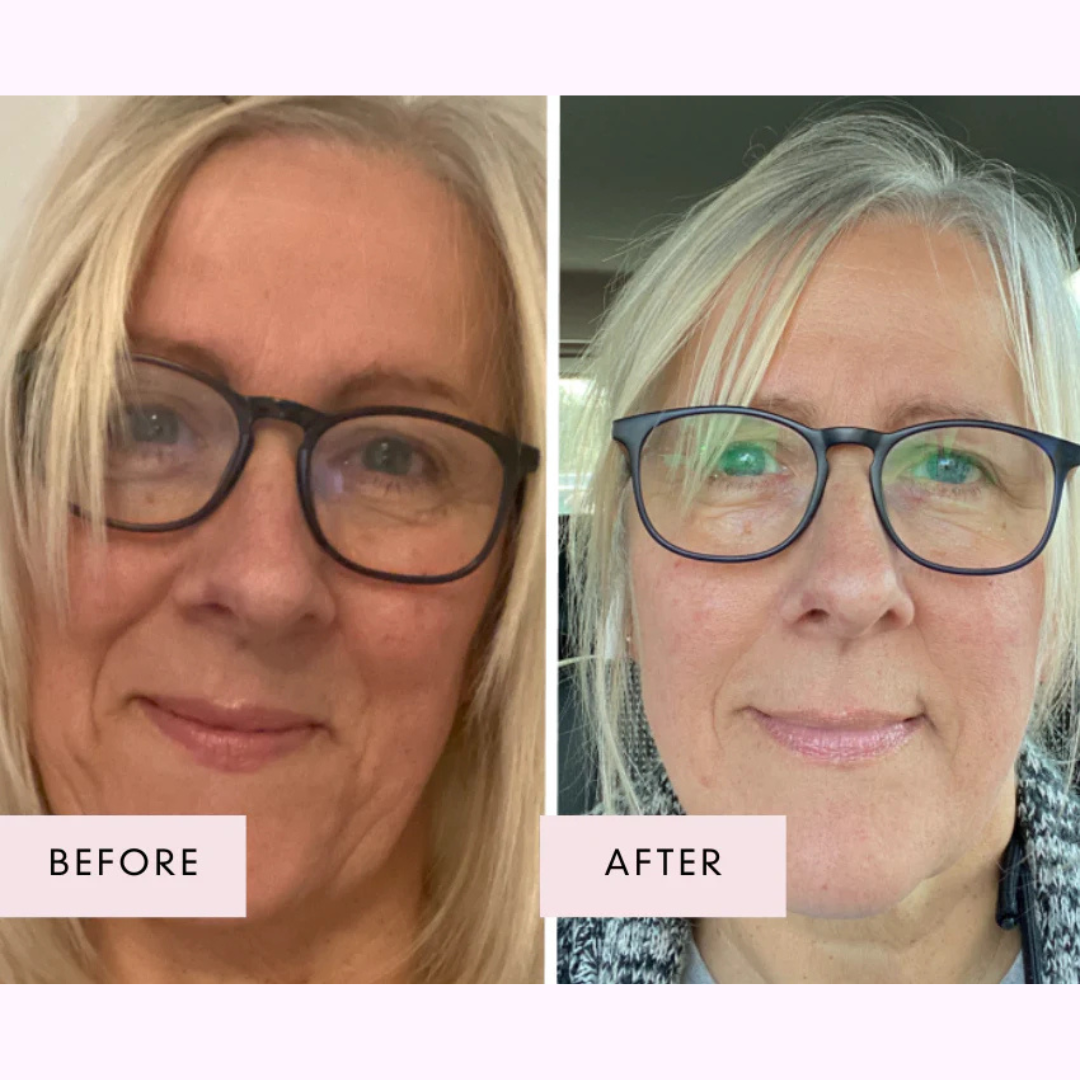 The Menopause Radiance Reset System